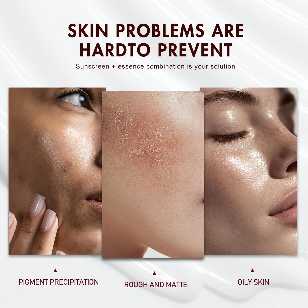 【FDA Approval】WORADA 10% Niacinamide Brightening Serum, revive serum，barrier care luxury，Public，Whitening Face Essence for Acne Marks and Dark Spots,, Whitening moisturizing Fast Redness Relief, Barrier Repair, Deep Hydration Glow Skin, All Skin Types
