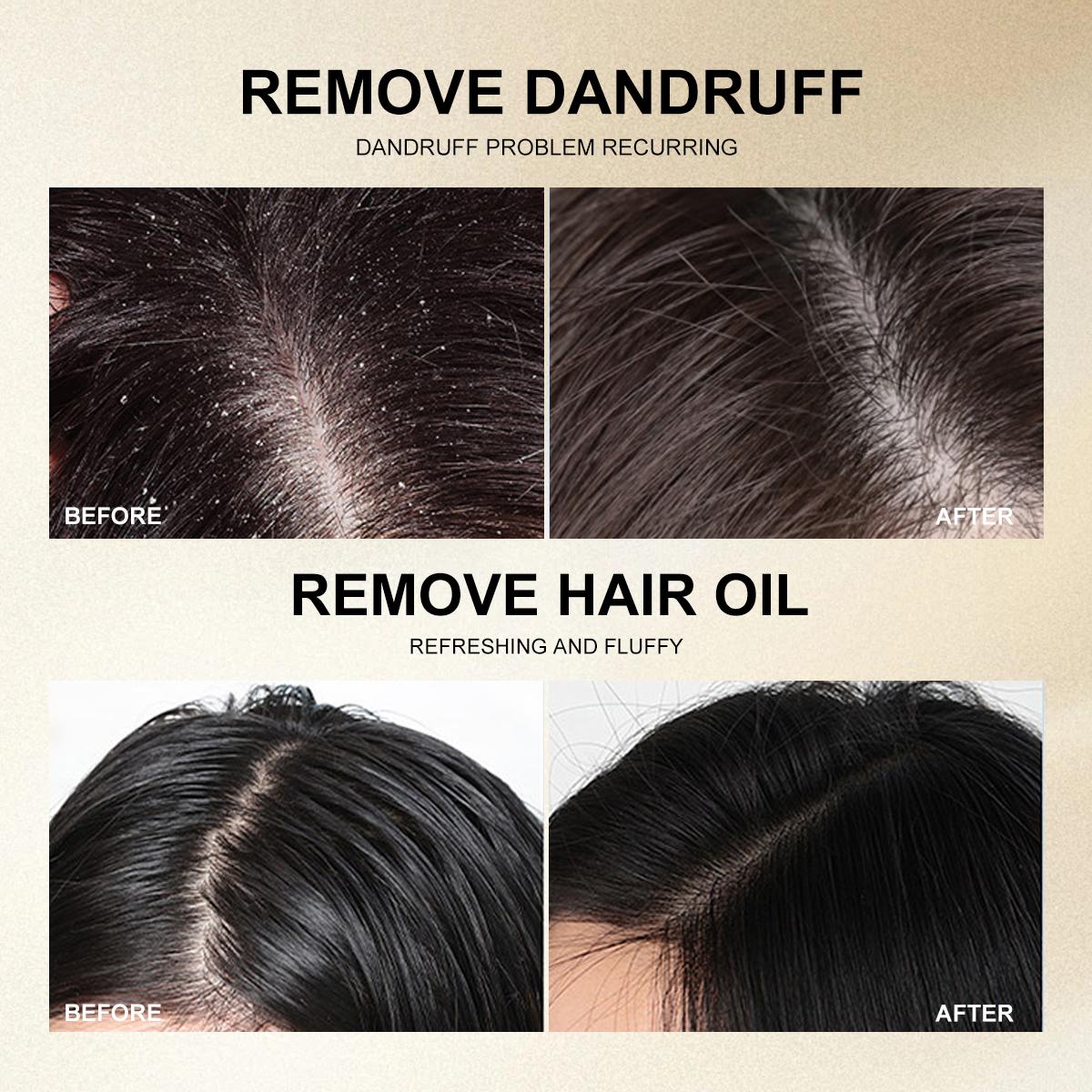 BUY 1 TAKE 1 WORADA amino acid shampoo anti-dandruff repair damaged hair dry hair care oil control shampoo 400ml improve damage/split ends, remove dandruff, control oil, anti-frizz, enhance curl, keep smooth