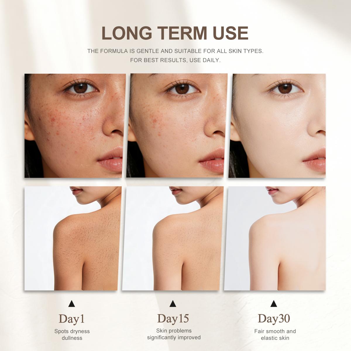 [FDA Approved] BUY 1 TAKE 1 WORADA SPF60 Sunscreen Sunblock + Papaya Whitening Lotion | Waterproof UV Protection | Brightening & Skin Repair | Deep Hydration Moisturizer | Body Care Combo | All Skin Types | Daily Use Glow Skin