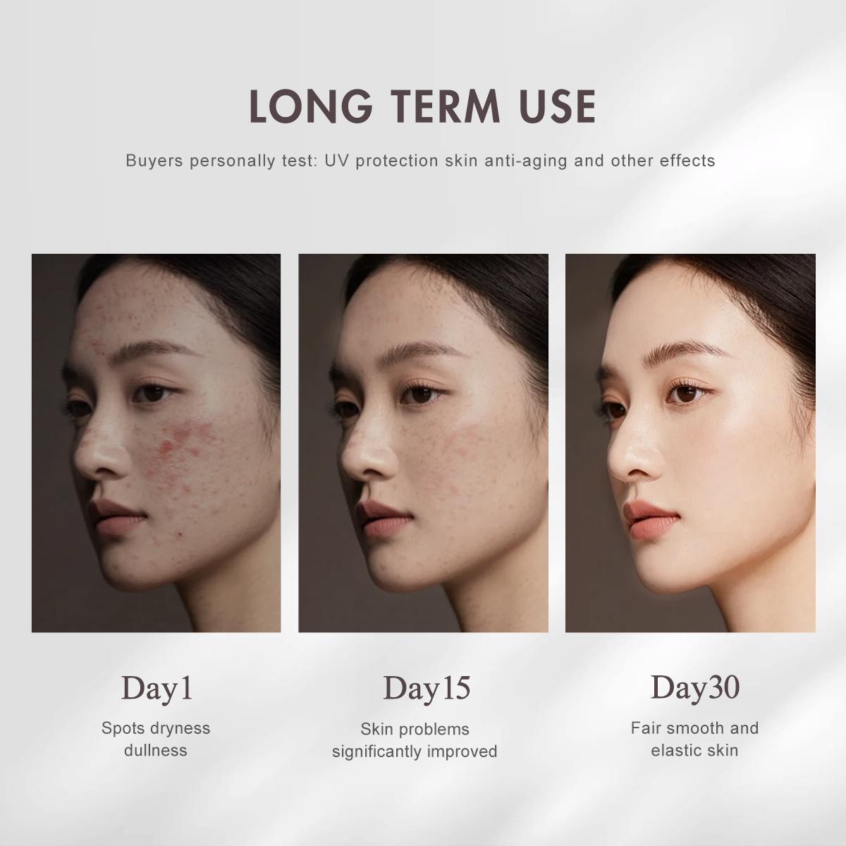 [FDA Approved] WORADA Niacinamide Serum 10% + SPF60 Sunscreen Set | Anti Acne Brightening Oil Control + Whitening Sunblock Waterproof Long Lasting UV Protection Hydrating Moisturizer Primer All Skin Types COD Buy 1 Take 1