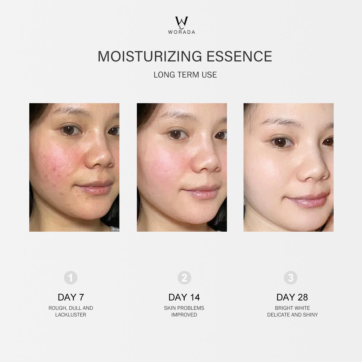 [FDA Approved] WORADA 4D-HA HYALURONIC ACID Nicotinamide WHITENING ESSENCE LIQUID 50ML | Moist and Smooth Skin | Enhanced Skin Radiance Serums Skincare Skin Repair Comfort Moisturizer Moisturize Pack Radiant Hydrating Brightening Moisture Daily Hydrate