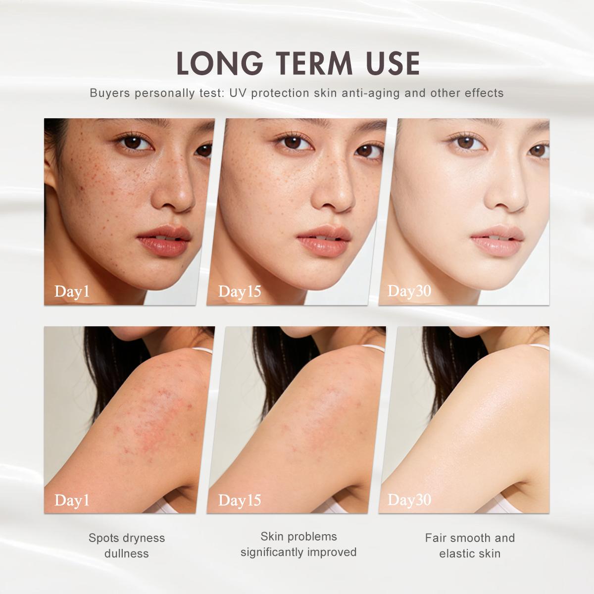[FDA Approved] WORADA SPF50 Whitening Body Sunscreen+10% Niacinamide Serum, Moisturizes, Brightens Skin, Repairs, Lightweight Daily Lotion, Controls Oil, Reduces Acne, Blemishes & Redness, Fast Results, All Skin Types, UV Protection, Glutathione Whitening