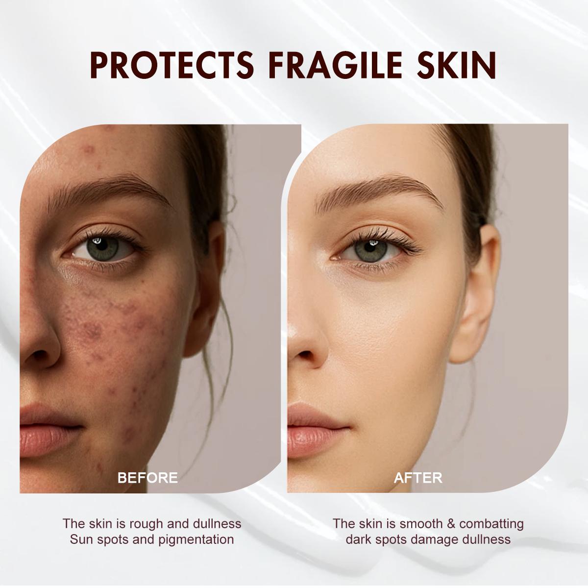 【FDA Approval】WORADA 10% Niacinamide Brightening Serum, revive serum，barrier care luxury，Public，Whitening Face Essence for Acne Marks and Dark Spots,, Whitening moisturizing Fast Redness Relief, Barrier Repair, Deep Hydration Glow Skin, All Skin Types