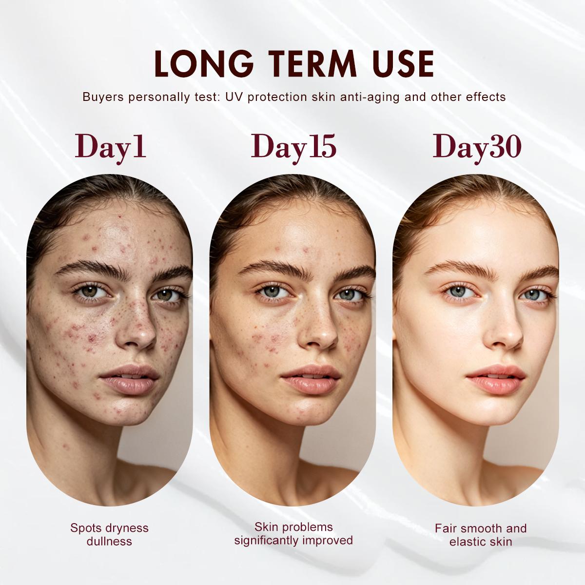 【FDA Approval】WORADA 10% Niacinamide Brightening Serum, revive serum，barrier care luxury，Public，Whitening Face Essence for Acne Marks and Dark Spots,, Whitening moisturizing Fast Redness Relief, Barrier Repair, Deep Hydration Glow Skin, All Skin Types