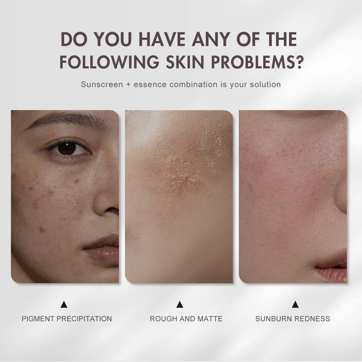 [FDA Approved] WORADA Niacinamide Serum 10% + SPF60 Sunscreen Set | Anti Acne Brightening Oil Control + Whitening Sunblock Waterproof Long Lasting UV Protection Hydrating Moisturizer Primer All Skin Types COD Buy 1 Take 1