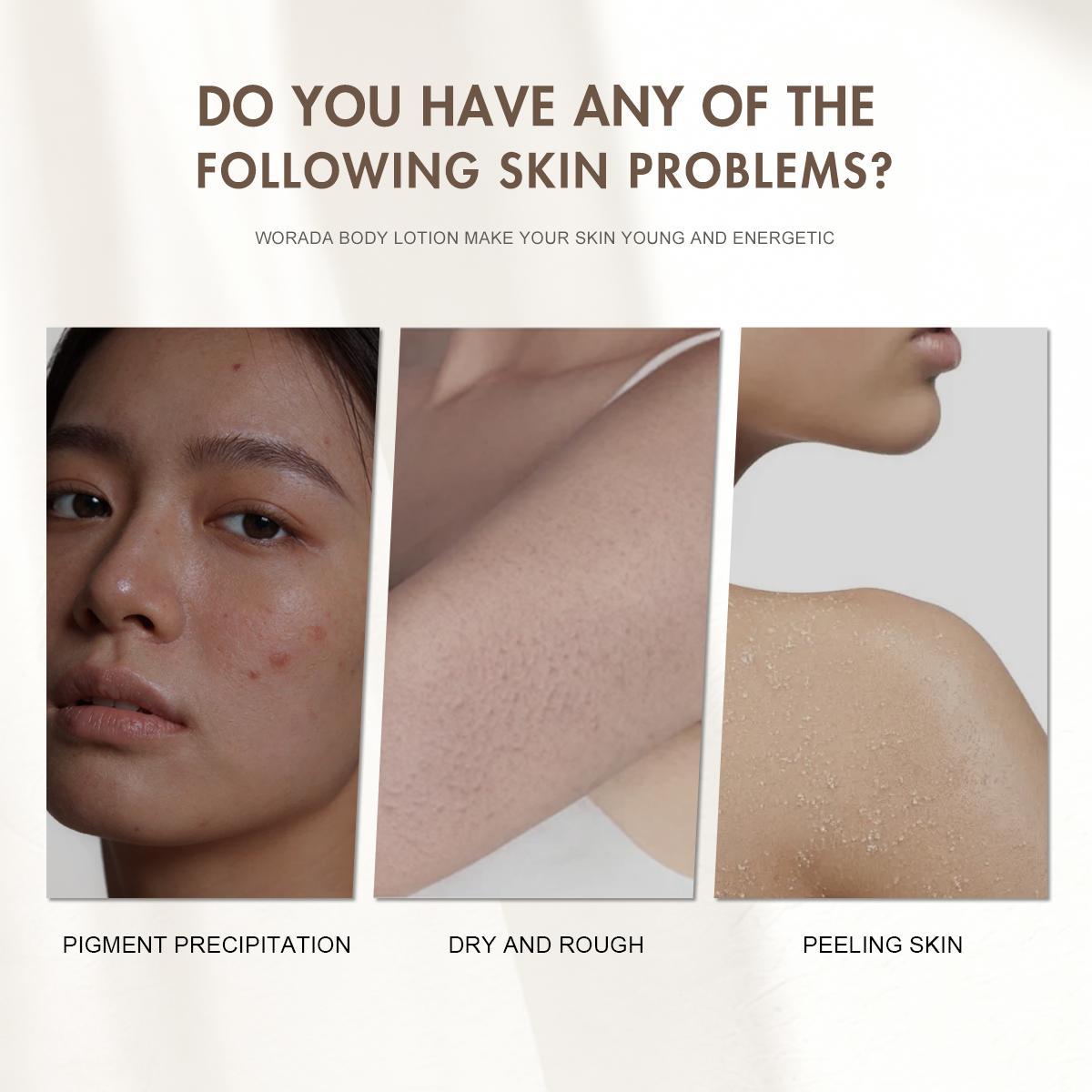 [FDA Approved] BUY 1 TAKE 1 WORADA SPF60 Sunscreen Sunblock + Papaya Whitening Lotion | Waterproof UV Protection | Brightening & Skin Repair | Deep Hydration Moisturizer | Body Care Combo | All Skin Types | Daily Use Glow Skin