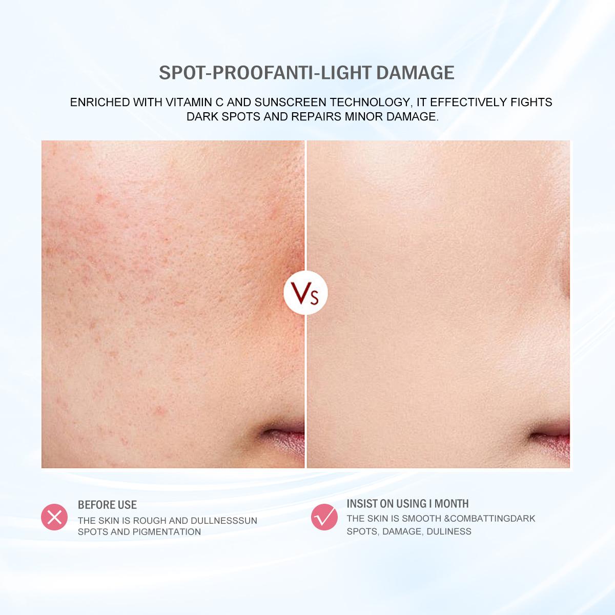 [FDA approved]WORADA 4-IN-1 Whitening Rejuvenating Set UV Plus Brightening Skin Care Kit with Vitamin C Foam Cleanser Hyaluronic Acid Essence SPF60 Sunscreen for All Skin Types Toner Soothing Repair Smooth Hydrating Moisture Moisturize  Hydrate Cleansing
