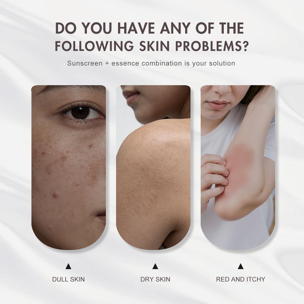 [FDA Approved] WORADA SPF50 Whitening Body Sunscreen+10% Niacinamide Serum, Moisturizes, Brightens Skin, Repairs, Lightweight Daily Lotion, Controls Oil, Reduces Acne, Blemishes & Redness, Fast Results, All Skin Types, UV Protection, Glutathione Whitening