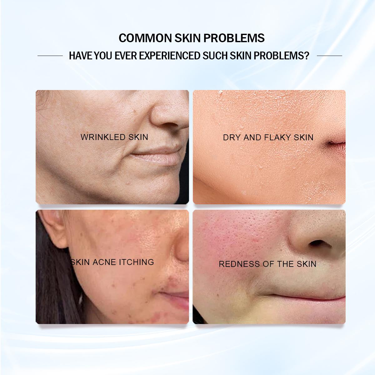 [FDA approved]WORADA 4-IN-1 Whitening Rejuvenating Set UV Plus Brightening Skin Care Kit with Vitamin C Foam Cleanser Hyaluronic Acid Essence SPF60 Sunscreen for All Skin Types Toner Soothing Repair Smooth Hydrating Moisture Moisturize  Hydrate Cleansing