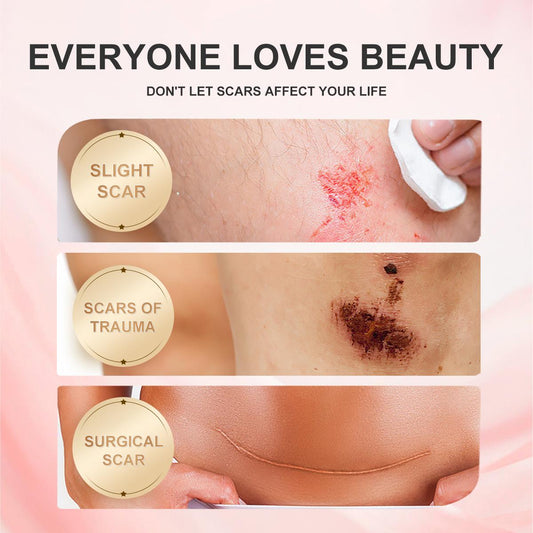 WORADA SCAR VANISH Gream with Collagen at Vitamin Scar Removal Cream 50g for Skin Repair at Comfort-Good for All Skin Types,Pimple Marks,at Dark Areas-Lotions,Moisturizer Stretchmarsk,Dark,Areas,Pimple Marks-good