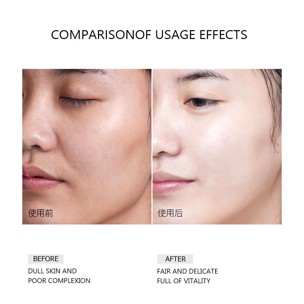 [FDA Approved] WORADA COMBO SPF60 SUNSCREEN AND 4DHA HYALURONIC SET sun protection,whitening and moisturing Facial Moisture Skincare Bright Hyaluronic Acid Nourishing Uv Skin Repair Comfort Moisturizer Gentle Radiant Hydrating Pack Hydrate Serums