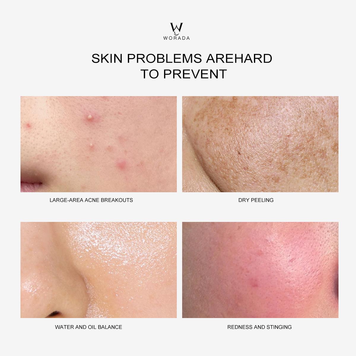 [FDA Approved] WORADA 4D-HA HYALURONIC ACID Nicotinamide WHITENING ESSENCE LIQUID 50ML | Moist and Smooth Skin | Enhanced Skin Radiance Serums Skincare Skin Repair Comfort Moisturizer Moisturize Pack Radiant Hydrating Brightening Moisture Daily Hydrate
