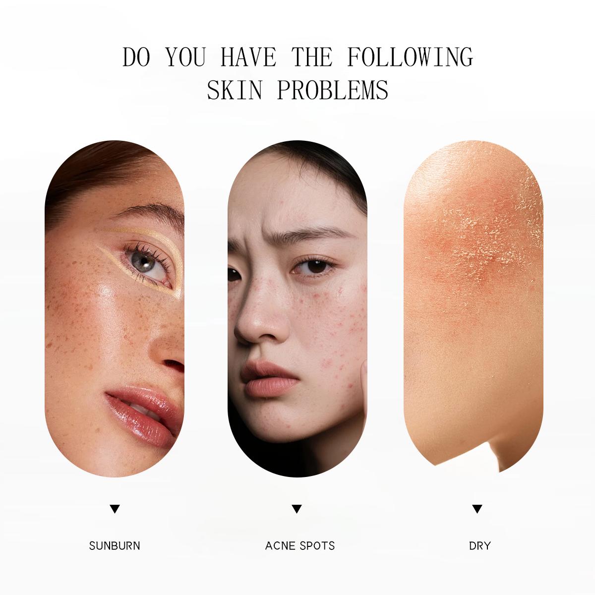 WORADA Anti Freckle Whitening Essence 120ML - Brightens Skin Tone, Hydrates, Calms Acne, for All Skin Types - Radiant & Flawless - Pack