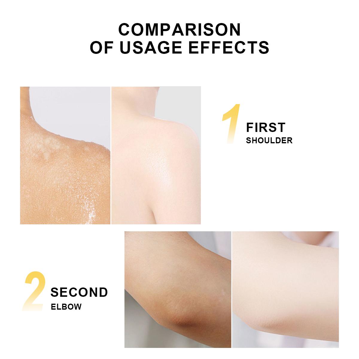 WORADA 10X Whitening Bleaching Whipped Melon Body Scrub 200g Exfoliating Gel Whitening Skin Cleaning Bath For All Skin Type (Niacinamide + Glutahione Cucumis melo extract) Body Care Skin Repair Skin Care Hydrating Moisturize Moisturizer Moisture Cleanser